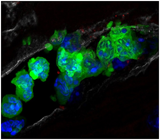 Descifran el mecanismo por el que un fármaco conocido hace décadas reduce el tamaño del infarto Descifran el mecanismo por el que un fármaco conocido hace décadas reduce el tamaño del infarto