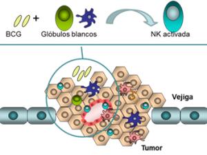 Tratamiento de cáncer de vejiga con BCG