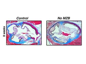 Descubren un papel protector 'inesperado' de un subtipo de células del sistema inmune frente a la aterosclerosis