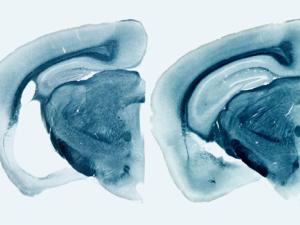 Reducción de áreas cerebrales en un ratón portador del gen ‘ApoE4’ humano (derecha). / YANG SHI (WUSM)