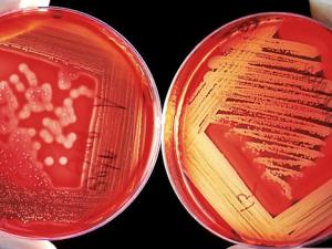 Hallan un vínculo entre las bacterias intestinales y la depresión