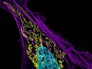 Cancer de hueso. / NIH Image Gallery (FLICKR)