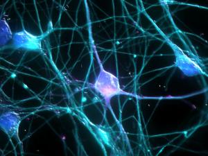 Neuronas. / UCI Research -Courtesy of OSA Student Chapter at UCI Art in Science Contest. Photo by: Ardy Rahman- (FLICKR)