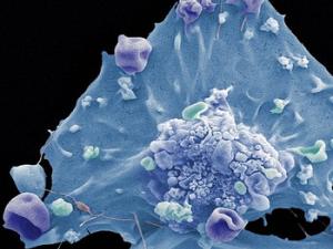 Célula de cáncer de mama. / Francisco Bengoa (FLICKR)