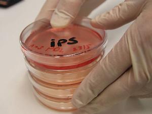 Desarrollado el primer 'mini-colon' humano a partir de células madre