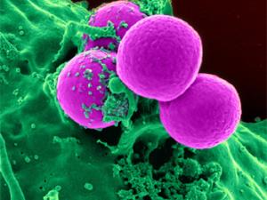 Glóbulos blancos. / Skeeze (PIXABAY)