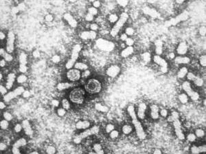 Virus hepatitis b. /  CDC (WIKIMEDIA)