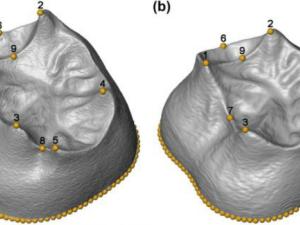 la aplicación de las nuevas tecnologías ha hecho posible el primer trabajo de morfometría geométrica sobre imágenes tridimensionales. / CENIEH