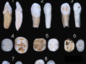 Muestras dentales de neandertales. / CENIEH