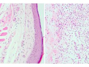 Cortes histológicos que muestran que en presencia de la proteína viral (izq.) se inhibe una infiltración de células inmunes (puntos oscuros) y mayor inflamación que en ausencia de ella (dcha.). / CSIC