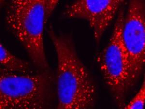 Identificación de nuevos moduladores de metástasis y mal pronóstico en el melanoma: Visualización de la proteína p62 (rojo) mediante microscopía de fluorescencia en células de melanoma. Las estructuras esféricas punteadas corresponden a grandes agregados de p62 con otras proteínas, entre ellas, factores que controlan múltiples procesos implicados en la supervivencia, proliferación e invasión de estas células tumorales. / CNIO