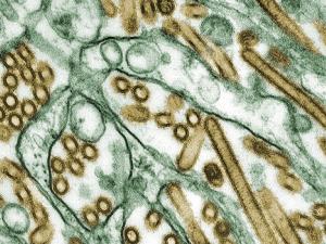 Orthomyxoviridae, H5N1. Influenza A H5N1 (dorado) creciendo en células MDCK (verde). / Cynthia Goldsmith (WIKIPEDIA)