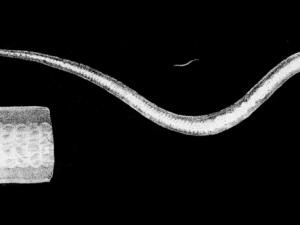 <i>Ascaris lumbricoides</i>. / Delorieux for Johann Gottfried Bremser (WIKIMEDIA COMMONS)
