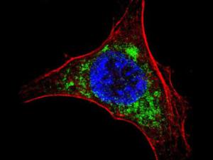 Célula infectada con la vacuna MVA-HCV produciendo las proteínas del virus de la hepatitis C, en verde. /  (CNB-CSIC)