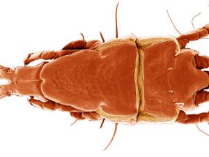 Ácaro de la especie Trouessartia bifurcata, una de las utilizadas en el estudio. / Heather C. Proctor