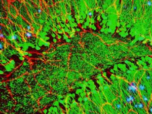 Microscopia de un cerebro con indicadores de la enfermedad de Alzheirmer (puntos en color azul). / ZEISS Microscopy (FLICKR)