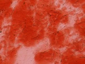 Células madre mesenquimales diferenciadas a células de hueso sobre matrices generadas a partir de fibroblastos tratados con LOX y BMP1. / Tamara Rosell García, Fernando Rodríguez Pascual.