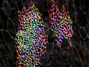 Nidos dorsales de histoblastos de Drosophila al inicio de su expansión. / IBMB