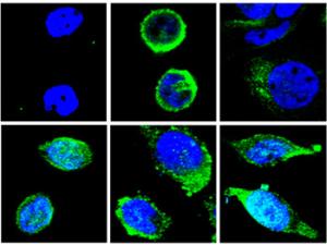 Caracterización fenotípica y funcional de los anticuerpos mediante microscopía confocal. / CSIC