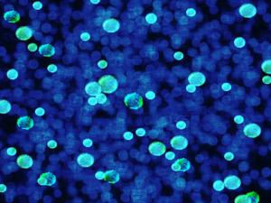 La miastenia grave, relacionada con alteraciones en la microbiota intestinal