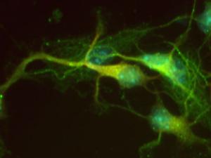 Muestra de neuronas. / CSIC Comunicación