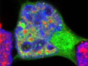 Demostrado uno de los mecanismos de supervivencia de las neuronas durante la vejez