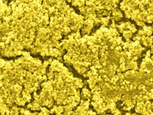 Imagen de microscopía con filtro amarillo de la bacteria ‘Staphylococcus aureus’ / (CSIC)