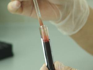 Muestra de sangre. / PublicDomainPictures (PIXABAY)