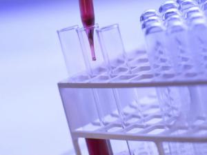 Un biomarcador predice la respuesta a la inmunoterapia al cáncer