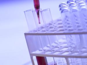 Descubren un calmante menos adictivo que la morfina