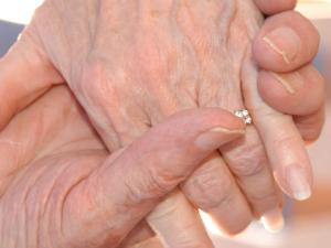 La piel envejece por la pérdida de identidad de las células