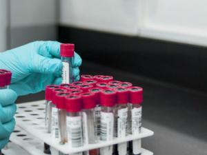 Identifican una proteína que aumenta el "colesterol bueno"