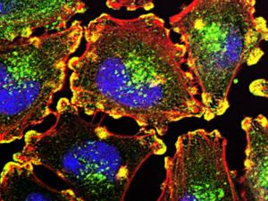 Células metastásicas del melanoma. / Julio C. Valencia, NCI Center for Cancer Research (FLICKR)