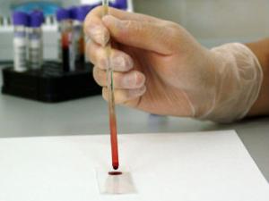 A partir de unas proteínas que se emplean como marcadores, puede identificar el órgano en el que se encuentra el tumor. / PublicDomainPictures (PIXABAY)