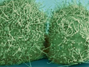 Desde que se identificó el primer virus humano, el que provoca la fiebre amarilla, en 1901, se han descubierto 263 virus que infectan a nuestra especie. / skeeze (PIXABAY)