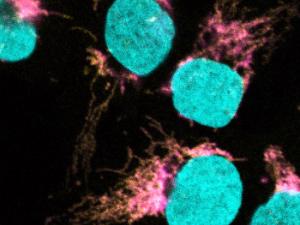 La microscopía confocal muestra la co-localización de EXD2 (magenta) con el ribosoma mitocondrial (amarillo). El ADN se tiñe para definir el núcleo (cian). / Travis Stracker, IRB Barcelona