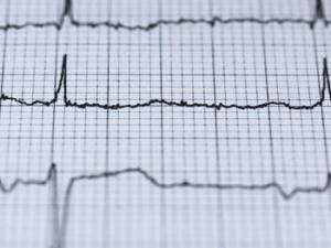 Resultados de un electrocardiograma. / stux (PIXABAY)