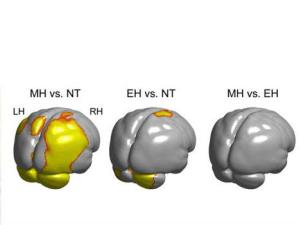 Comparación de la morfología de los cerebros de los neandertales (NT), los humanos modernos (MH) y los primeros H. sapiens (EH). En gris se ve un cerebro tipo donde aparecen marcadas en amarillo las zonas donde hay diferencias significativas en el tamaño de los cerebros de las especies que se comparan. Como se puede apreciar, tanto el cerebelo como el occipital están muy marcados en la comparación entre humanos modernos y neandertales mientras que no hay esas diferencias cuando comparamos los cerebros de lo