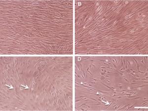 Cultivos de fibroblastos humanos/Durán et al 2018
