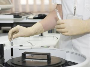 La biopsia líquida y la secuenciación masiva ponen nombre y apellidos al cáncer de pulmón más frecuente. / DarkoStojanovic (PIXABAY)