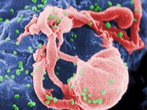 Microfotografía con MEB de VIH-1 en liberación (en verde) en un cultivo de linfocitos. Esta imagen ha sido coloreada para resaltar las características importantes; para la imagen original en blanco y negro véase PHIL 1197. Las múltiples protuberancias redondeadas sobre la superficie celular representa los sitios de ensamblado y gemación de viriones. / C. Goldsmith (WIKIPEDIA)