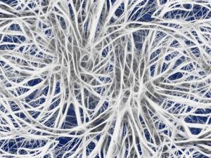 Descubren la diferencia cerebral que nos hace únicos