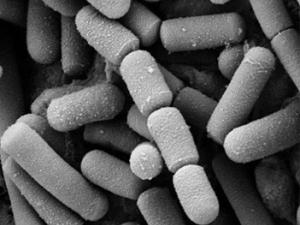 Bacillus cereus, bacteria patógena para los humanos que puede ser infectada por el virus Bam35. / Mogana Das Murtey and Patchamuthu Ramasamy (WIKIMEDIA)