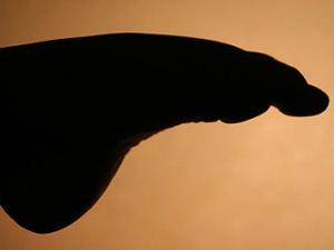 Recreación de la enfermedad de Charcot-Marie-Tooth. / Olivier GENDRIN (FLICKR)