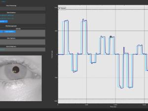 Diagnóstico de enfermedades neurodegenerativas a través de los movimientos oculares. / AURA Innovative Robotics