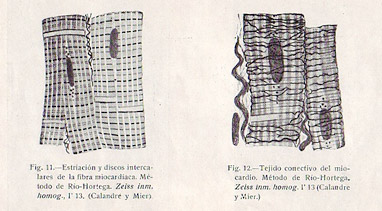 Preparaciones (Del libro Anatomía y Fisiología Clínicas del Corazón) Preparaciones (Del libro Anatomía y Fisiología Clínicas del Corazón)