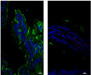 Un estudio en ratas demuestra que administrar tres cepas de probióticos disminuye la inflamación intestinal